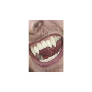 Scarecrow Deluxe Werewolf Fangs - Image 2