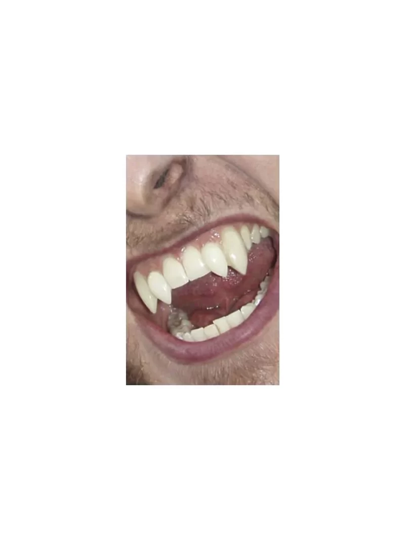 Scarecrow Deluxe Werewolf Fangs - Image 2